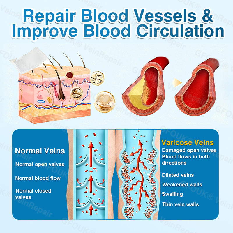 🇨🇦🏅🦵✨GFOUK® VeinRepair Microneedle Patch Roll⚡Instant Relief, Long-Term Results