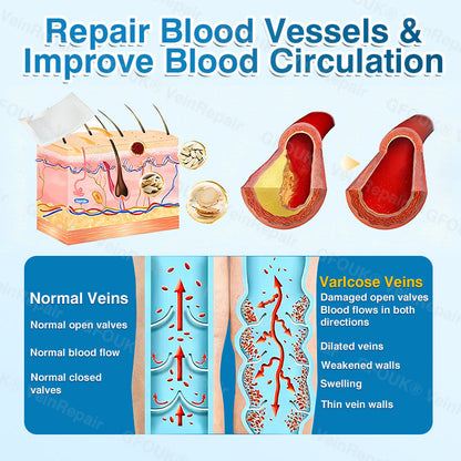 🇨🇦🏅🦵✨GFOUK® VeinRepair Microneedle Patch Roll⚡Instant Relief, Long-Term Results