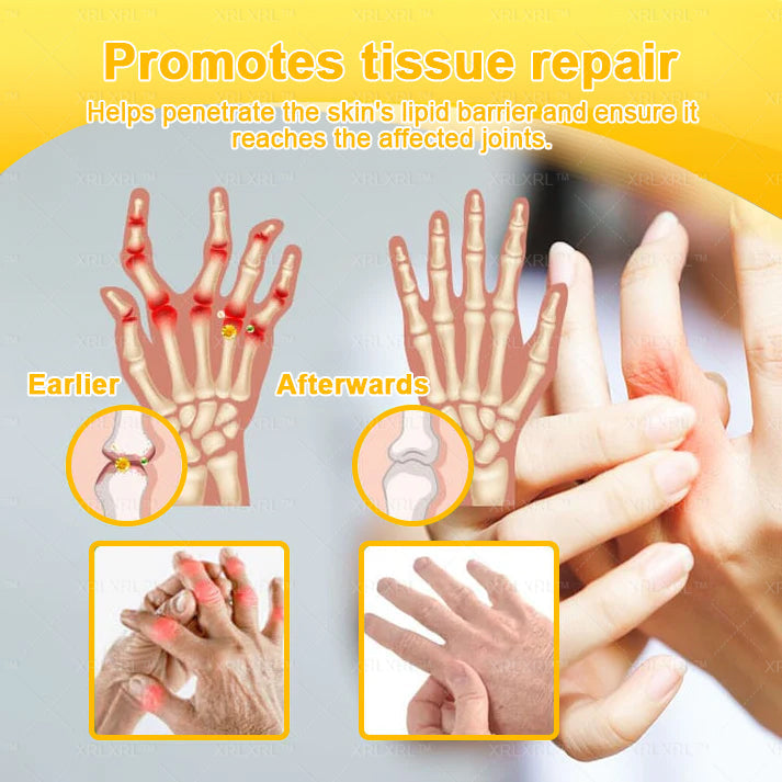 XRLXRL® Bee Venom Pain-Relief Bone Healing Cream 👨‍⚕️👨‍⚕️(Specially for older adults)