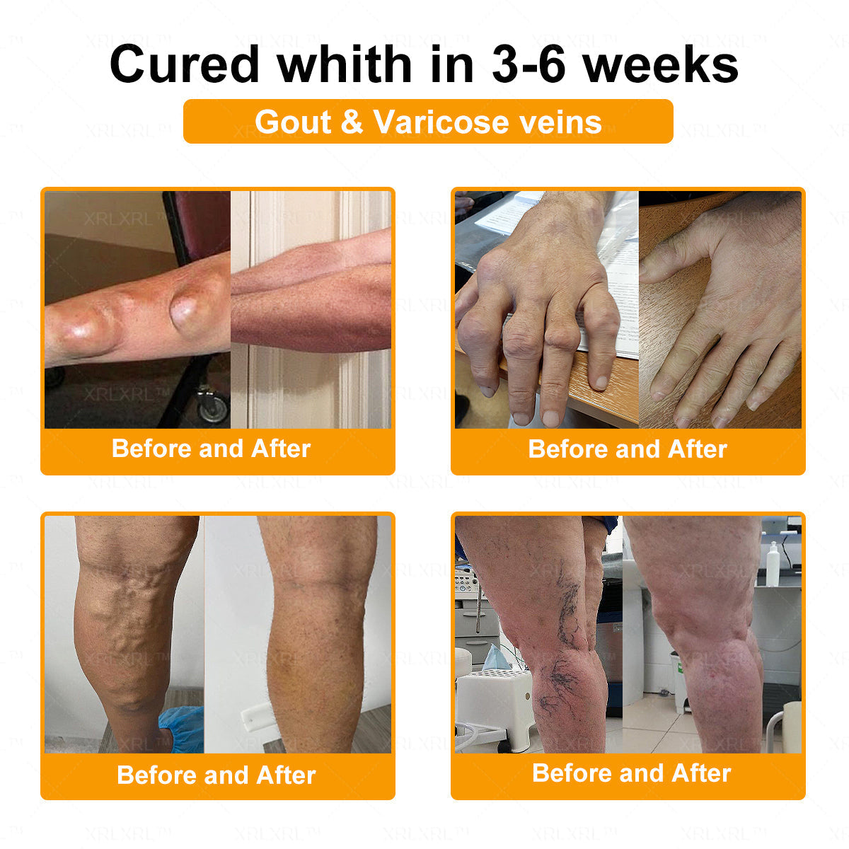 XRLXRL® Bee Venom Pain-Relief Bone Healing Cream 👨‍⚕️👨‍⚕️(Specially for older adults)