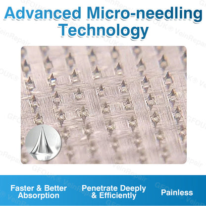 🇨🇦🏅🦵✨GFOUK® VeinRepair Microneedle Patch Roll⚡Instant Relief, Long-Term Results