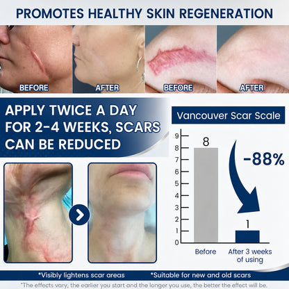 Hixvor™: Flatten, Fade, And Improve Your Scars In 14 Days