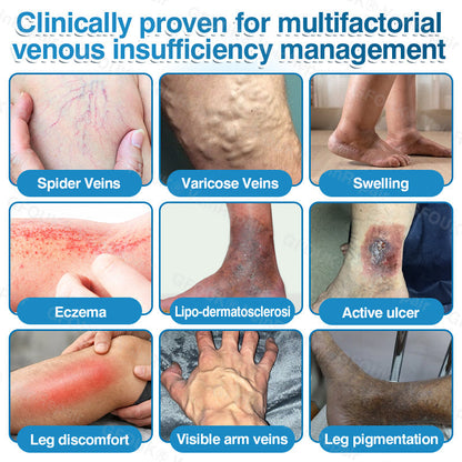 🇨🇦🏅🦵✨GFOUK® VeinRepair Microneedle Patch Roll⚡Instant Relief, Long-Term Results
