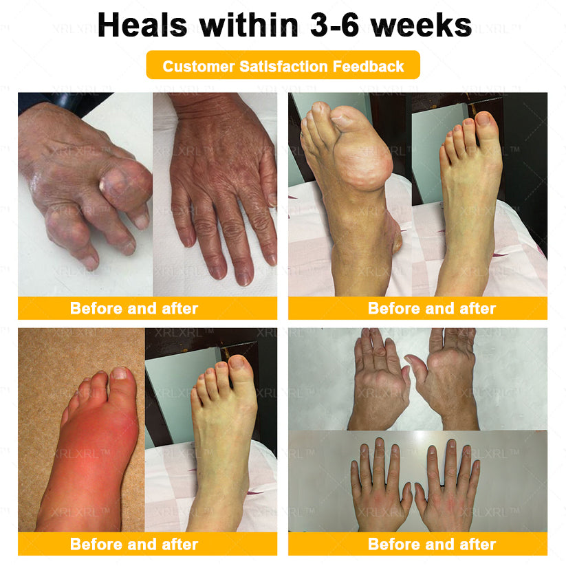 XRLXRL® Bee Venom Pain-Relief Bone Healing Cream 👨‍⚕️👨‍⚕️(Specially for older adults)
