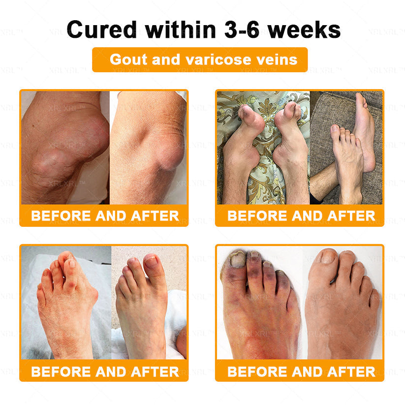 XRLXRL® Bee Venom Pain-Relief Bone Healing Cream 👨‍⚕️👨‍⚕️(Specially for older adults)