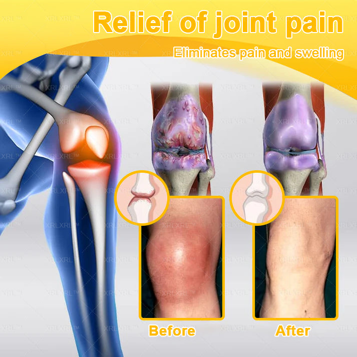 XRLXRL® Bee Venom Pain-Relief Bone Healing Cream 👨‍⚕️👨‍⚕️(Specially for older adults)