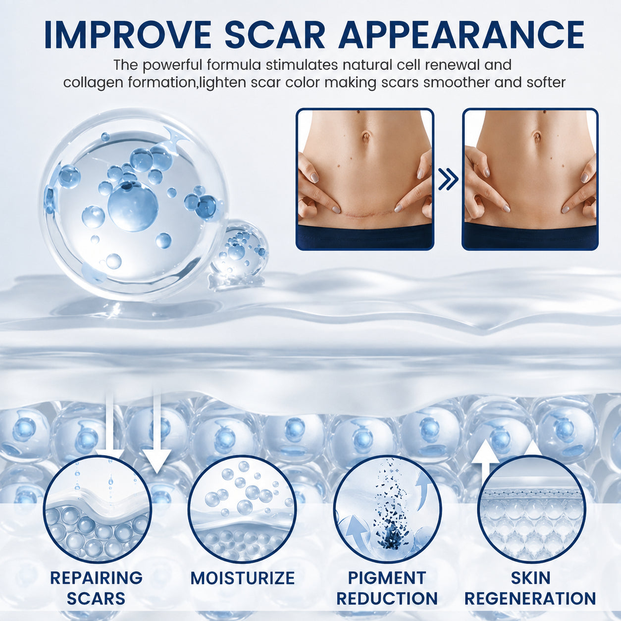 Hixvor™: Flatten, Fade, And Improve Your Scars In 14 Days