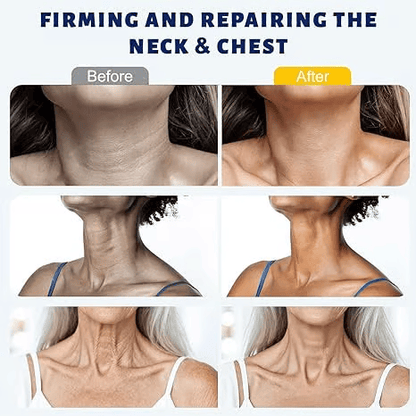 ✨ Tryurvplus™ Instant Neck Lift Cream  —  🧴 Infused with Retinol & Hyaluronic Acid | Firms the Neck, Reduces Wrinkles & Double Chin